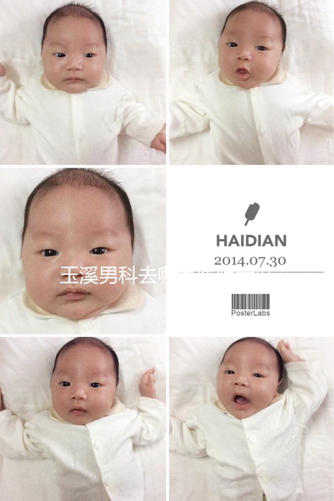 玉溪男科去哪家醫(yī)院看好，怎么選攻略，這個(gè)排行榜不要錯(cuò)過(guò)