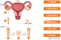 玉溪到昆華醫院做試管嬰兒怎么樣？詳細費用明細如下