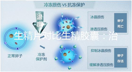 生精片對比生精膠囊:治療少精弱精,你得這么選!