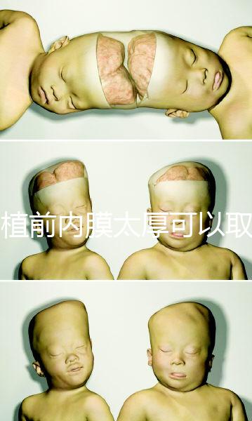 移植前內(nèi)膜太厚可以取卵早知道，疼痛因人而異