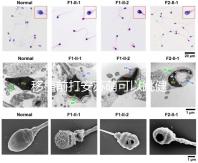 移植前打安蘇萌可以跳健身操嗎？你得到了嗎？