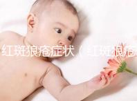 紅斑狼瘡癥狀（紅斑狼瘡癥狀表現有哪些）