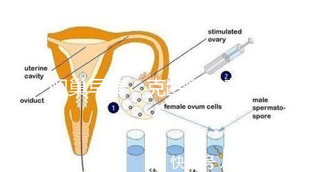 卵巢早衰，克齡蒙和芬嗎通藥物選擇引爭議