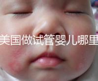 去美國做試管嬰兒哪里最好，4家好評輔助生殖機構推薦