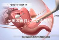 全國試管嬰兒成功率高的醫院排名，內附2023試管費用及成功率參考