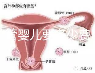 做試管嬰兒要多少費(fèi)用(做試管嬰兒要多少費(fèi)用?)