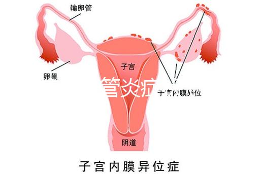 反流性食管炎癥狀(反流性食管炎癥狀有哪些反應(yīng))
