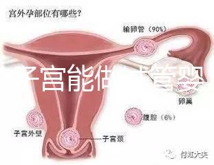 雙角子宮能做試管嬰兒嗎?可以,但這2大條件缺一不可