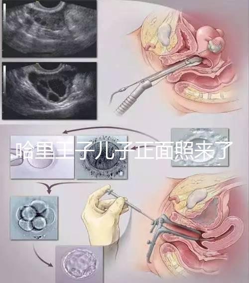 哈里王子兒子正面照來(lái)了,梅根評(píng)價(jià):氣質(zhì)甜美,乖巧