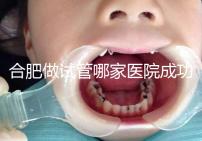 合肥做試管哪家醫院成功率最高（合肥做試管哪家醫院成功率最高的）