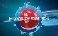 同卵雙胞胎形成原因揭秘，發(fā)育過(guò)程圖帶你弄清其中原理