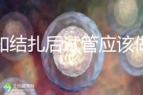 告知結扎后試管應該做什么準備，是否有照片檢查，有答案