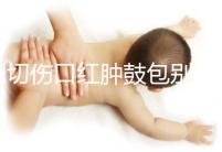 側(cè)切傷口紅腫鼓包別擔(dān)心，分階段和步驟教你護(hù)理