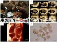 人授取精時緊張有無影響別還不造，注意事項不少不可不知