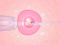 二代試管嬰兒成功率（二代試管嬰兒成功率取決于什么）