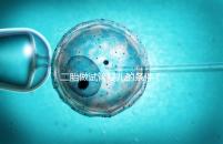 二胎做試管嬰兒的條件（試管二胎流程和費用）