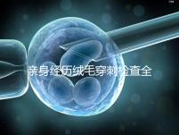 親身經(jīng)歷絨毛穿刺檢查全過程分享，預(yù)約掛號是第一步