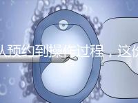 從預約到操作過程，這份tct檢查流程攻略請查收