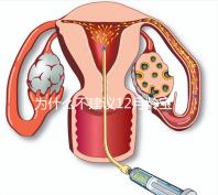 為什么不建議12月齡寶寶打水痘疫苗，醫生道出其中端倪