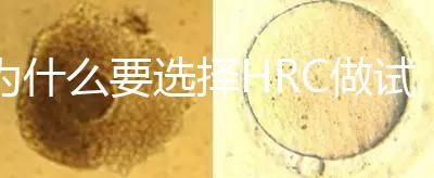 為什么要選擇HRC做試管？這6大優勢看完就知道答案