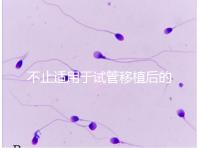 不止適用于試管移植后的胚胎著床,美卓樂(lè)的8大作用盤(pán)點(diǎn)