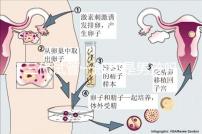 三代試管一般都是男孩嗎（三代試管一般都是男孩嗎還是女孩）