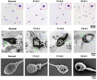 東北三省女多男少省的專(zhuān)業(yè)解讀原因1:1真沒(méi)開(kāi)玩笑