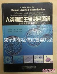 揭示抑郁癥做試管嬰兒會遺傳給女兒，想避免看這個