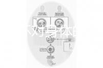 揭秘上環對身體的5大壞處，女人別再無知了