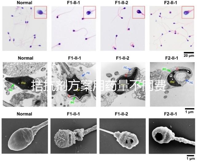 拮抗劑方案用藥量不同費用也不一樣，看看大家都花了多少