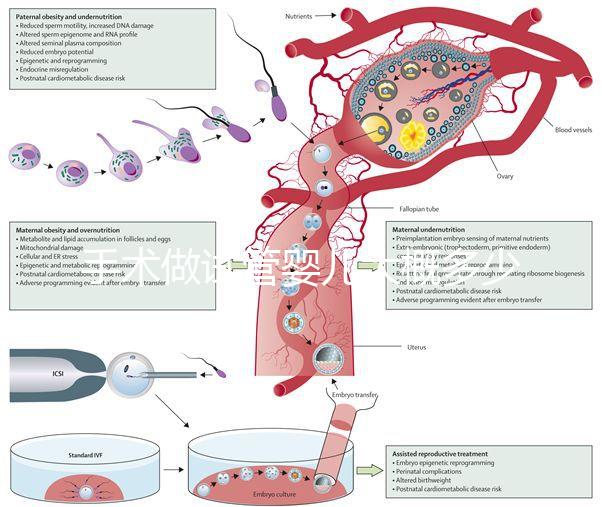 手術做試管嬰兒大概多少錢(手術做試管嬰兒大概多少錢啊)