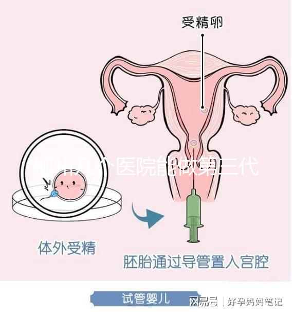 柳州幾個醫院能做第三代試管嬰兒？詳細的費用成功率都在這