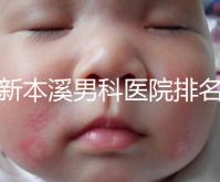 更新本溪男科醫院排名，不要錯過本溪湖區top3醫生的專業