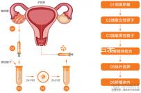 無性婚姻做試管嬰兒后來怎么樣？三個大案例揭開了內幕