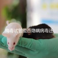 梅毒試管能否隱瞞病毒還沒有建造，備案記錄已經通知