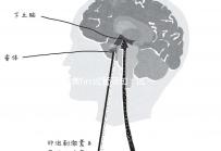 夢美hrc試管須知：試管嬰兒提升成功率有這幾個方法