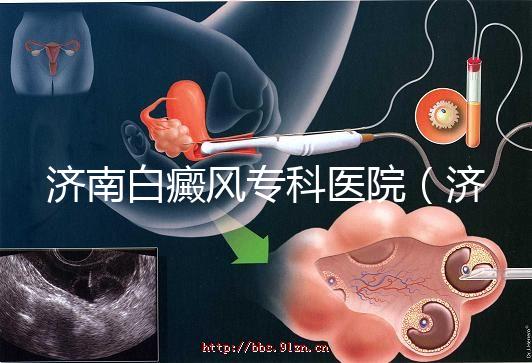 濟(jì)南白癜風(fēng)?？漆t(yī)院（濟(jì)南白點(diǎn)癲風(fēng)醫(yī)院排名）