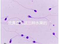 流鼻血與這三種水果的“奇妙”關系，建議少吃，多補充維生素K可以幫助止血！