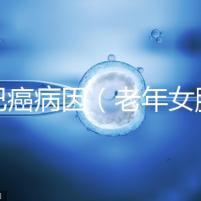 淋巴癌病因（老年女腋下淋巴癌病因）