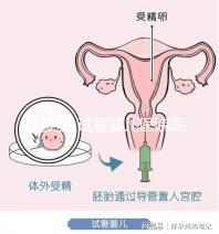 孕多多-試管嬰兒醫(yī)院醫(yī)生_試管嬰兒哪家醫(yī)院好_試管嬰兒全過程流程注意事項(xiàng)