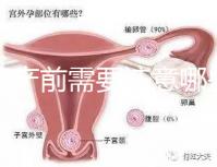 孕婦產前需要注意哪些事項？