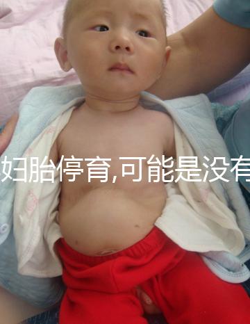 孕婦胎停育,可能是沒(méi)有做好沒(méi)做好檢查,這3個(gè)辦法值得嘗試