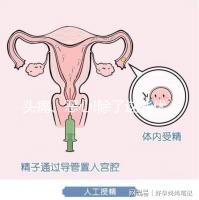 頭痛、惡心!除了這些優(yōu)思明副作用還有哪些