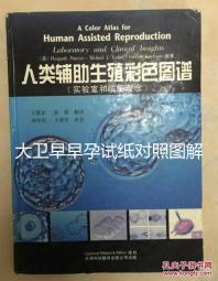 大衛早早孕試紙對照圖解，教你怎么看結果是不是陽性