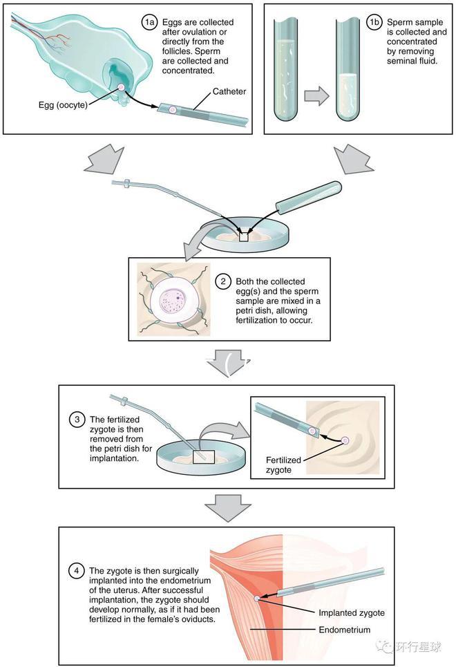婦科病癥狀(婦科病癥狀表現(xiàn)有哪些呢)