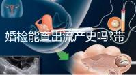 婚檢能查出流產(chǎn)史嗎?帶你詳細解答相關(guān)疑惑