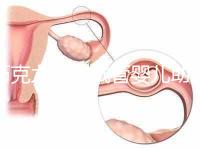 巧克力囊腫試管嬰兒助孕應先治療？網友看法均有差異