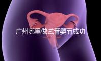 廣州哪里做試管嬰而成功率高？如何提高成功率？