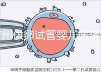 廣州供卵試管嬰兒醫院匯總，真實案例告訴你廣東哪家最好