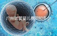 廣州試管嬰兒費用知多少？2025年廣州試管全過程費用與流程清單